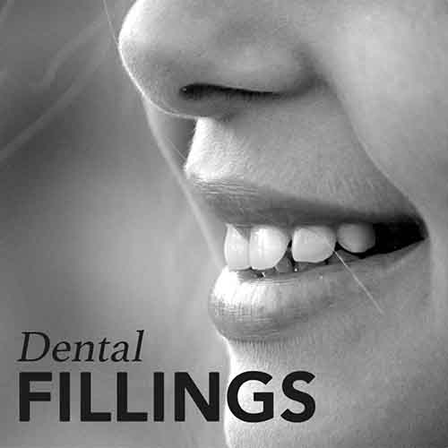 Dental Fillings