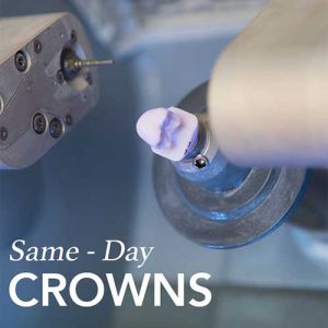 Same-Day Crown in Sunnybank Hills