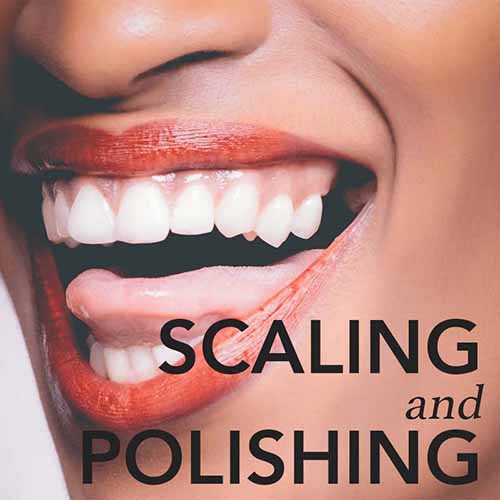 Scaling and Polish Sunnybank Hills Aperture Dental Practice