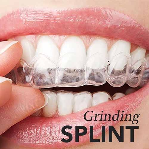 Splint