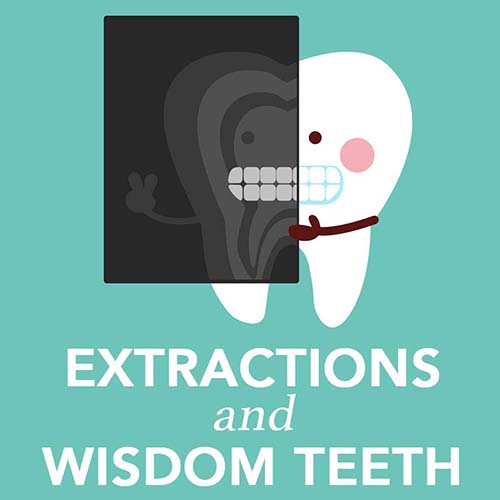 Extraction and Oral Surgery