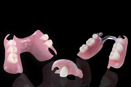 Removable Partial Dentures