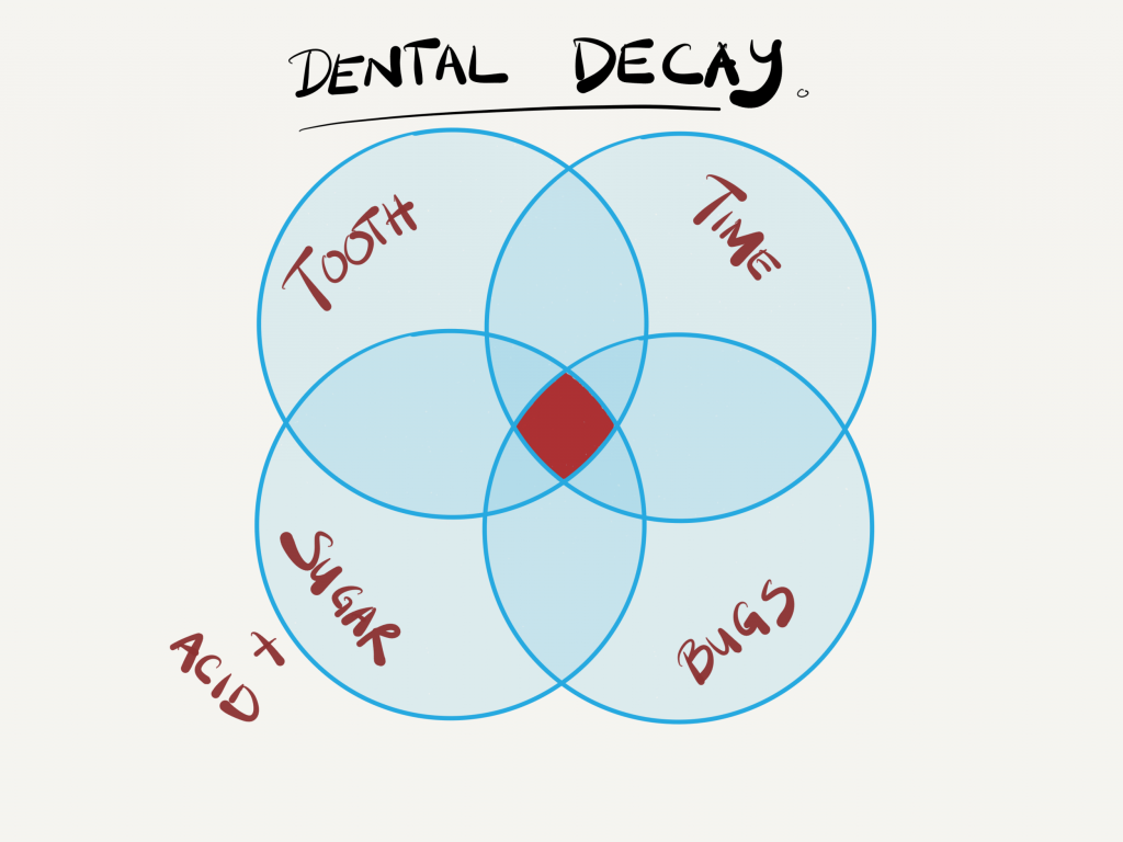 What causes dental decay