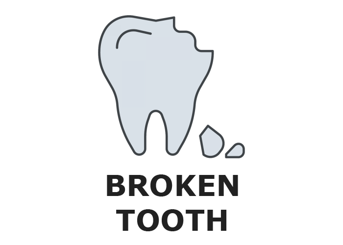 Broken Tooth