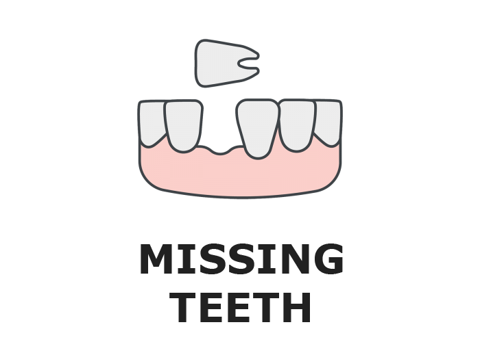 Missing Teeth