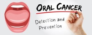 Read more about the article Oral Cancer – Detection and Prevention