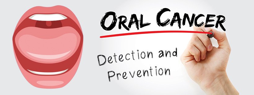 You are currently viewing Oral Cancer – Detection and Prevention