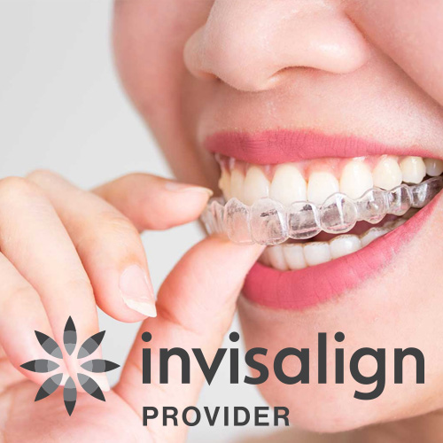 Invisalign Clear Aligners in Sunnybank Hills