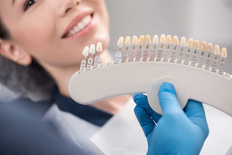 A dentist matches a patient's dental veneers with her tooth colour