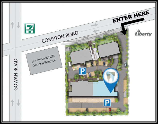 Aperture-Dental-Practice-Sunnybank-Hills-location-map-directions